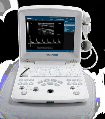 DUS 60 new compact ultrasound system