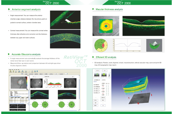 OCT2000 Optical coherence tomography/ ophtalmic OCT